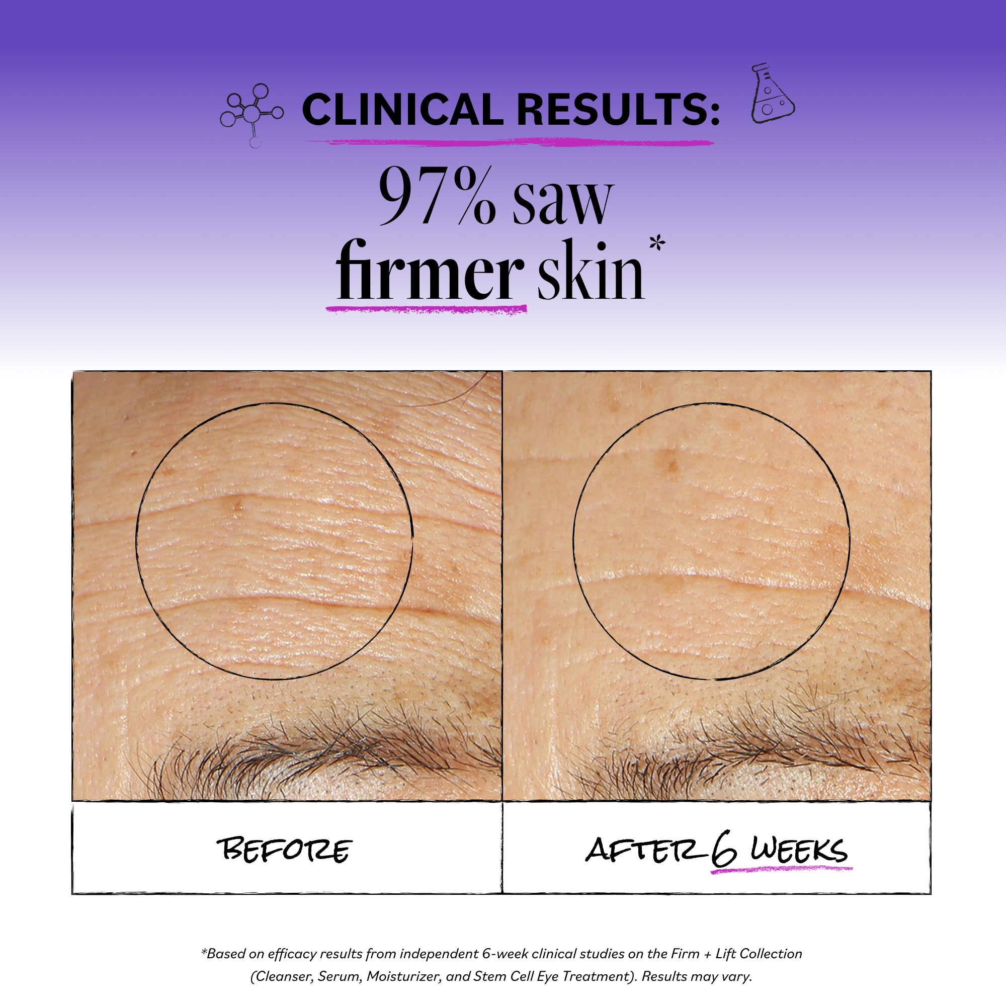 4100_ClinicalResults.jpg